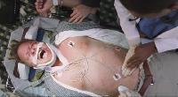 ER